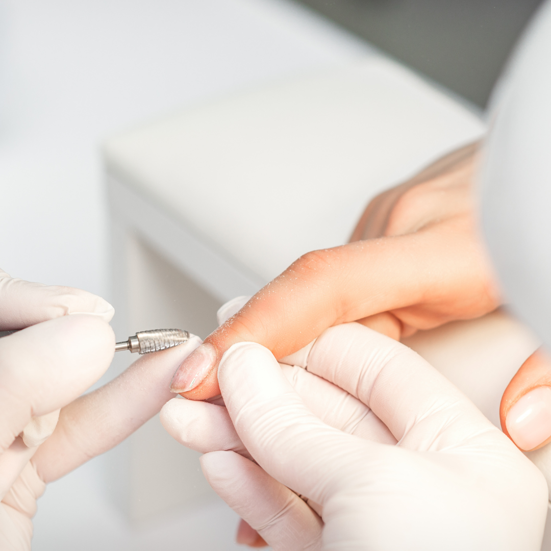 Nail Removal