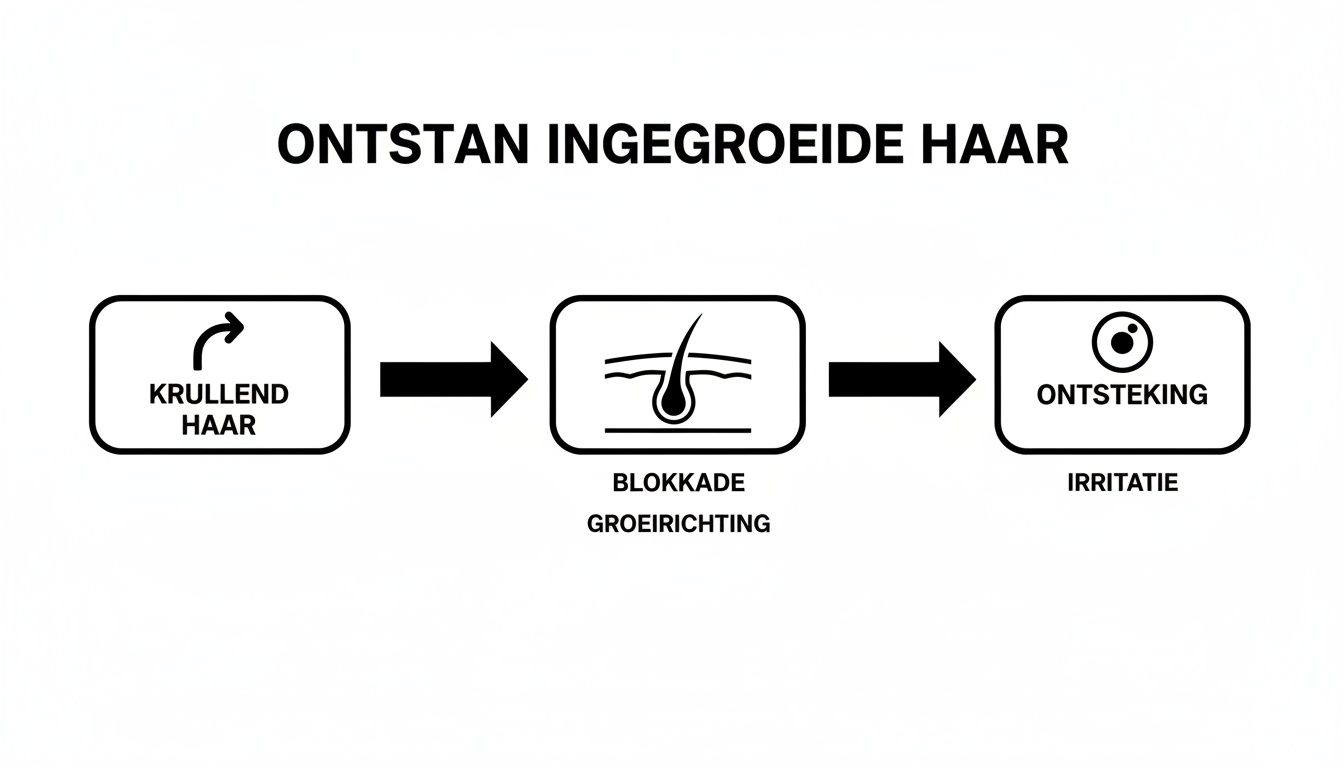 Dit stroomdiagram illustreert hoe ingegroeide haren ontstaan, van krullend haar tot blokkade en uiteindelijke ontsteking en irritatie.