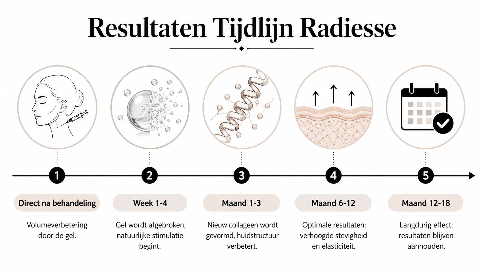 Een tijdlijn die de fasen en resultaten van een Radiesse huidbehandeling na verloop van tijd laat zien.