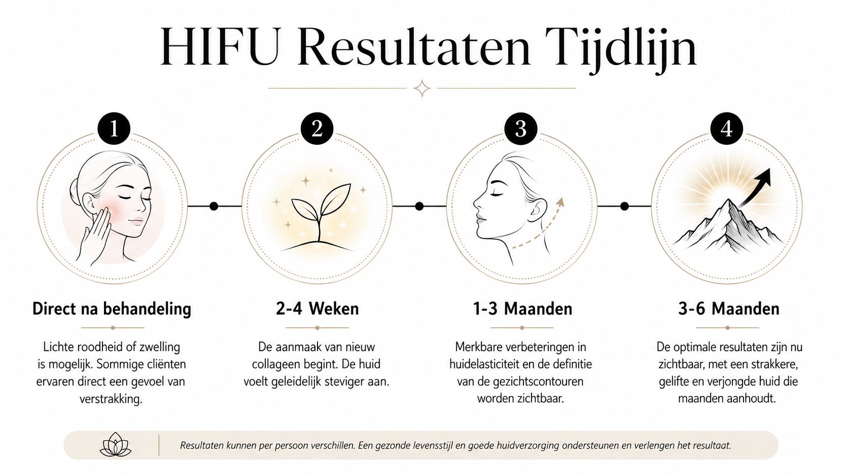 Een tijdlijn-infographic die de geleidelijke resultaten en het genezingsproces na een HIFU-gezichtsbehandeling in verschillende fasen weergeeft.