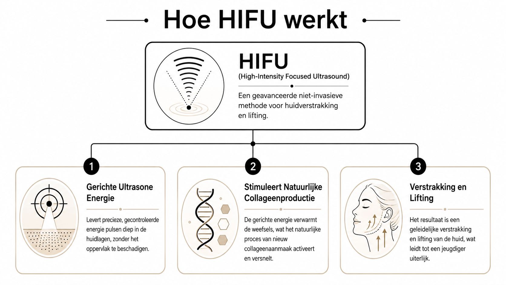 Een informatieve infographic die uitlegt hoe de HIFU-behandeling werkt voor huidverstrakking en een jeugdiger uiterlijk.