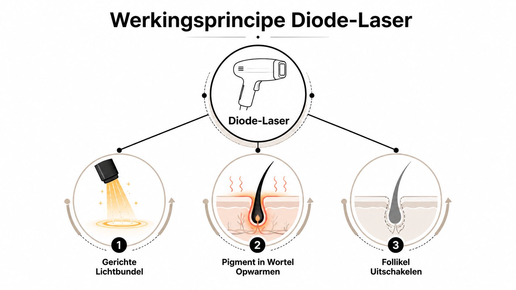 Een overzichtelijke infographic die het werkingsprincipe van ontharing met een diode-laser in drie stappen uitlegt.