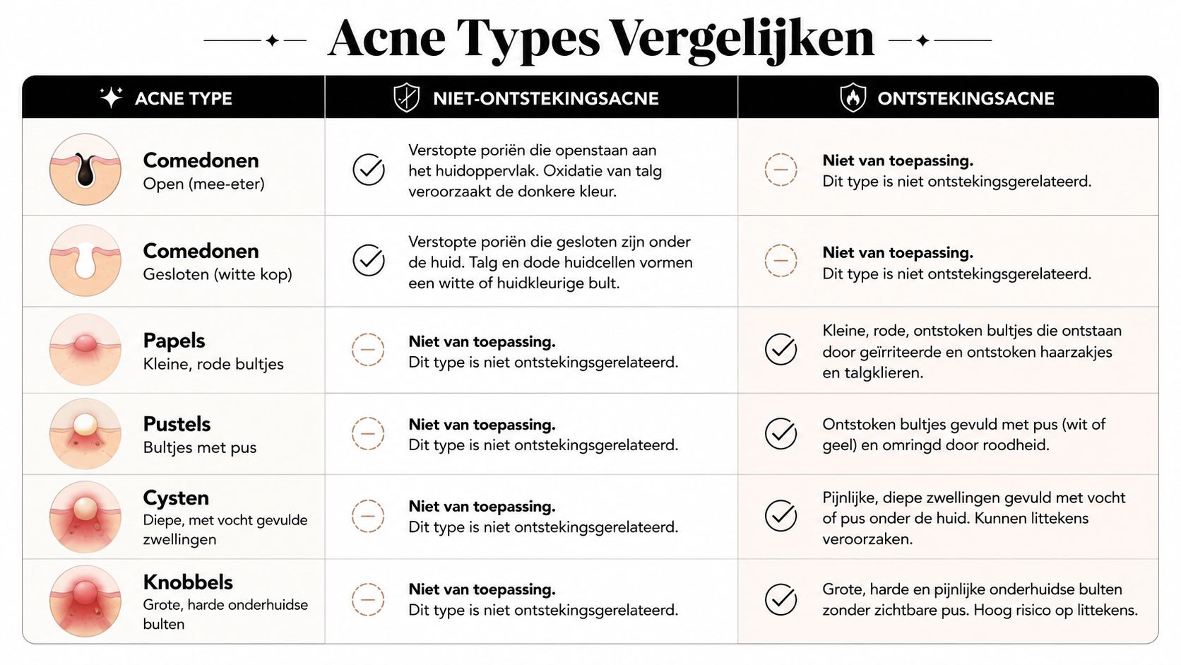 Een overzichtstabel in het Nederlands die verschillende soorten acne vergelijkt, ingedeeld in niet-ontstekingsacne en ontstekingsacne.